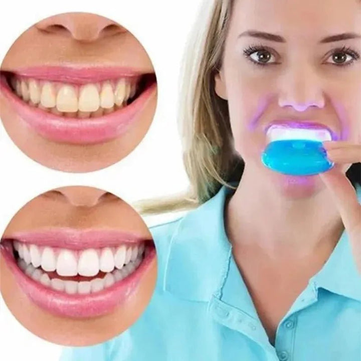 Portable LED Teeth Whitening Light Blue Light Teeth Bleaching Whiten Lamp Home Use Oral Care Lamp Tool Dentals Whitening Kit - Nook Nest Online Store